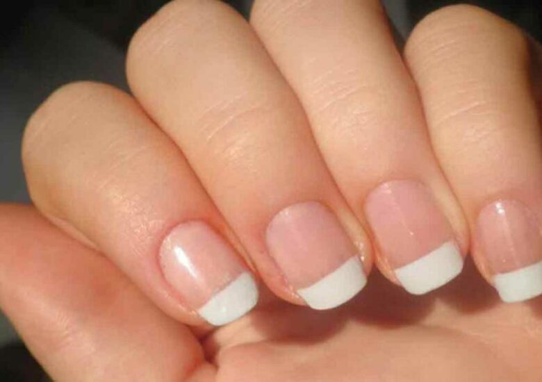Los colores de las uñas reflejan padecimientos de salud