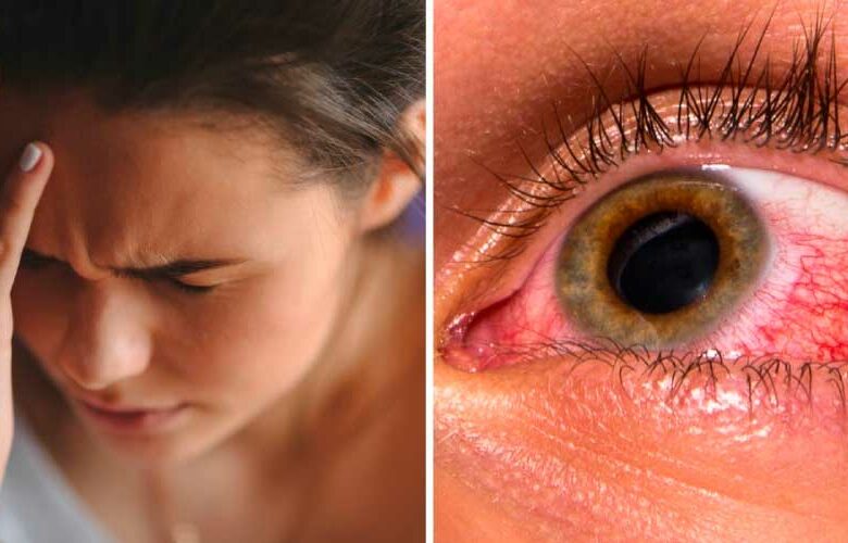 Glaucoma: el enemigo silencioso que puede causar ceguera
