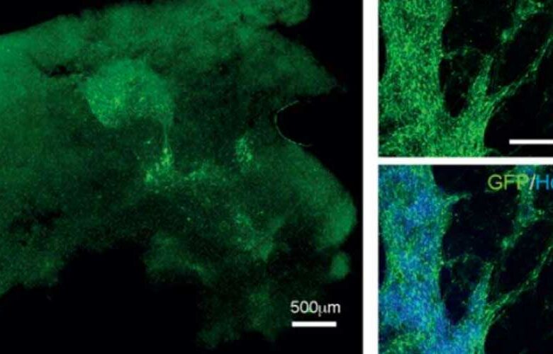 Crean neuronas que pueden integrarse al tejido cerebral humano