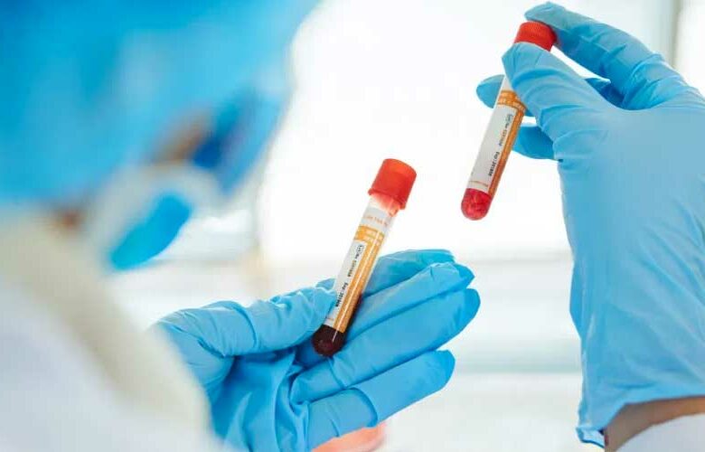 Qué comer según la dieta del tipo de sangre